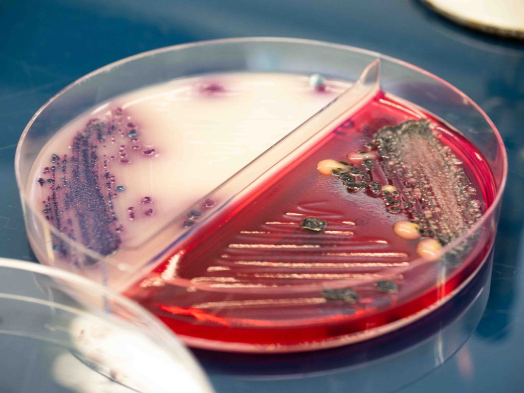 Analyse des surfaces hospitalières hygiène hospitalière microbiologie par Laboratoire QUALYSE