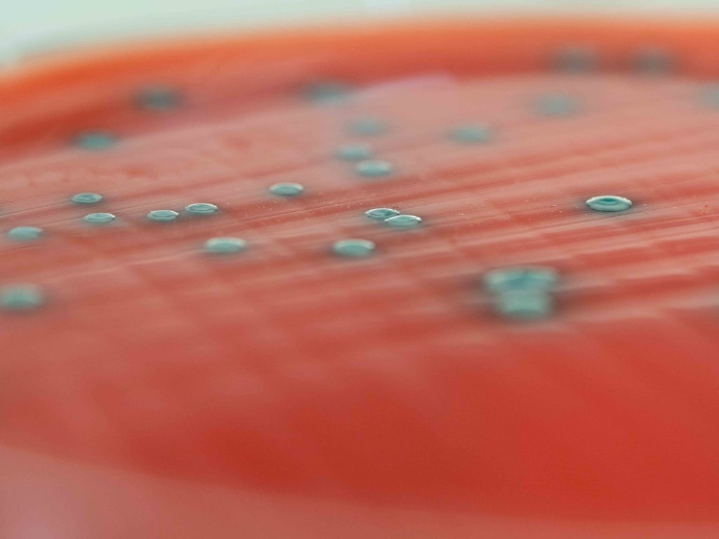 Autocontrôles microbiologiques vérification PM hygiène alimentaire QUALYSE