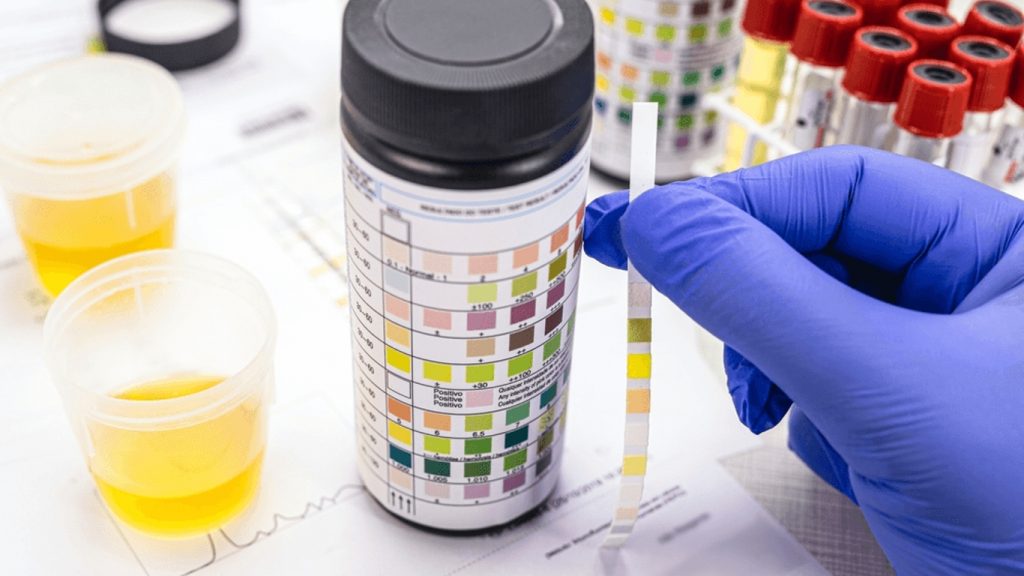 ECBU pour animaux de compagnie par Labo QUALYSE